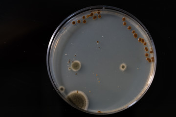 petri dish with bacteria, isolated on black