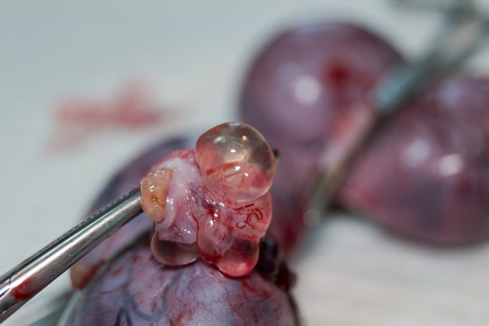 uterus of a cat with pyometra and a big ovarian cyst