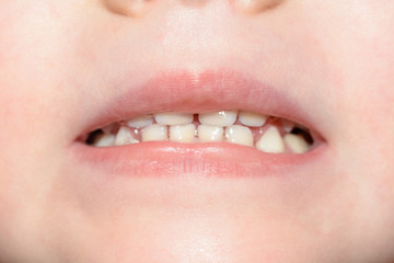 Little baby's teeth are shot at the macro when she laughs