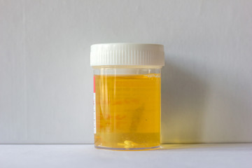 urine sample collected in a plastic container for urine culture and protein test isolated on a white background.  