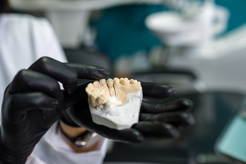 Dental technician holding denture cast, close-up.