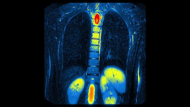 Computed medical tomography MRI upscaled scan of healthy young female torso. Front view. Optically retimed for smooth motion. Red, yellow, blue on black background.
