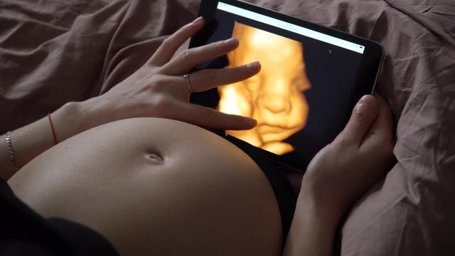 Pregnant woman look at ultrasound photo in tablet computer. 4K.