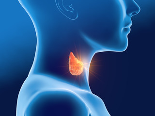 Thyroid cancer of a woman, medically 3D illustration, front view