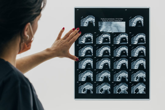 Dentist woman checking a dental x-ray using window natural light