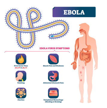 Ebola Vector Illustration. Labeled Virus Bacteria Infection Symptoms Scheme