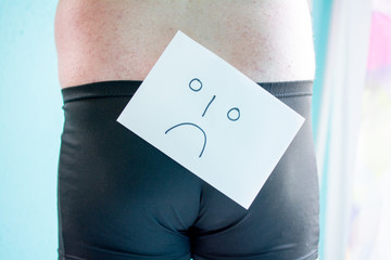 Hämorrhoiden,Analbereich,Juckreiz,Blutungen,