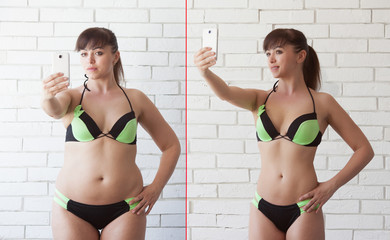 Comparison of women before and after weight loss. Diet and healthy nutrition. Liposuction results.