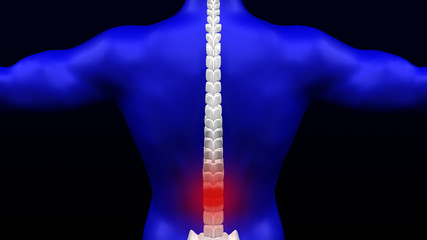 Lower back pain. 3D rendering.