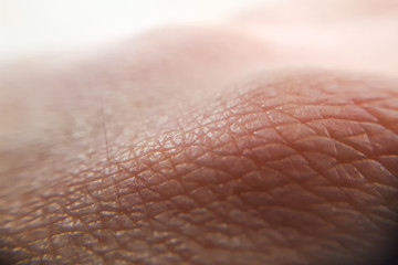 Fototapeta premium macro skin of human hand.Medicine and dermatology concept. Details of human skin background