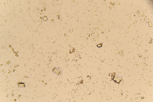 Urine Crystals, Red Blood Cells And Leukocytes At The Microscope. Urinary Tract Disease In Cat