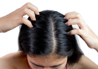 Naklejka premium women head with dandruff Caused by the problem of dirty. Or caused by skin disease or Seborrheic Dermatitis. It has white scaly and it will cause itch.