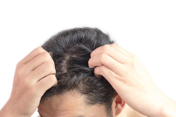 Fototapeta premium Grey hair on theyoung man head. Hair Dye Product Concept.