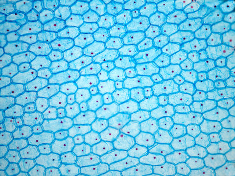 Onion epithelium.