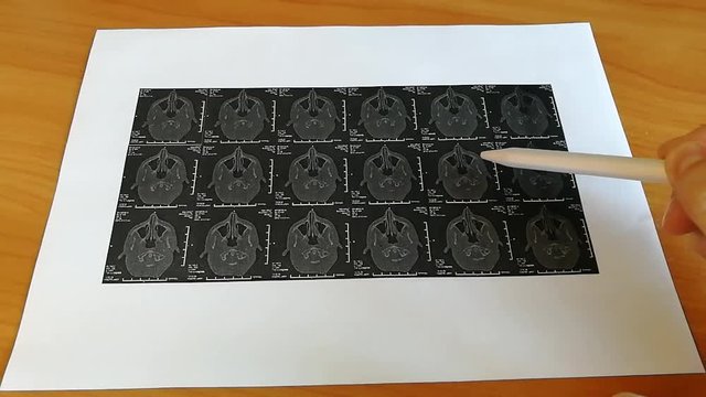 MRI scan of patient by d
