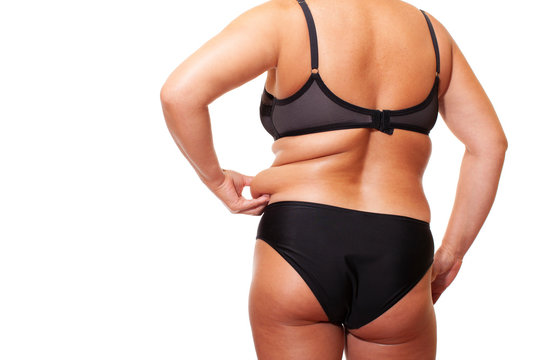 obesity, female body back in underwear. - image