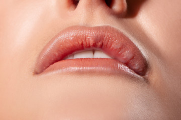 Fototapeta premium Lips close up. Beauty. lumps in the lips after Botox infection, a side effect. Makeup. 