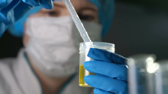 Doctor examining an urine sample