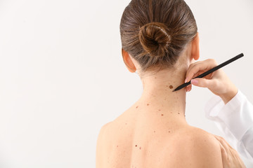 Dermatologist applying marks onto patient's skin before moles removal against light background