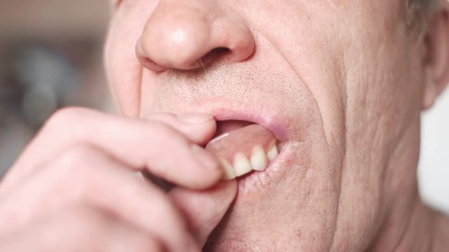 The mouth of an elderly man with false teeth. An older man pulls his upper jaw out of his mouth. Grandpa takes off his false teeth. Mouth close up, slow motion, 4K