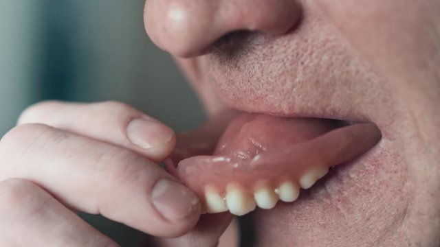The mouth of an elderly man with false teeth. An older man inserts his upper jaw into his mouth. Grandfather with false teeth. Mouth close up, slow motion, 4K