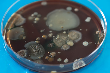 Petri dish with colonies of bacteria