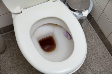 Close-up Of Dirty Toilet Bowl