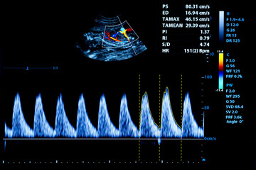 Colourful image of modern ultrasound monitor
