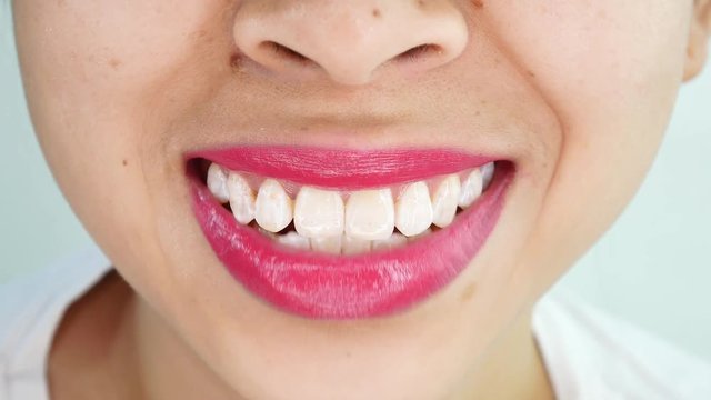 Close up mouth of Asian young woman speaking, laughing with white teeth over white background in studio.