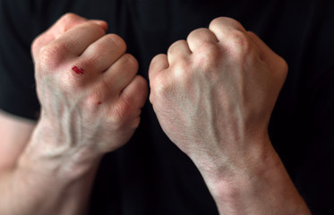 boxing fists with blood close up. motivation.