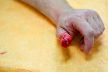 Close-up bloody wound of the thumb