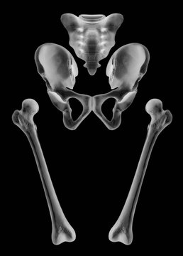 Separate Human bones of Hip and Lower limb- Healthcare-  X ray film-Human Anatomy and Medical concept-Isolated on black background.