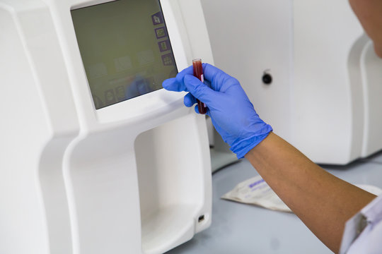Blood haematology analyzer. Close up of medical worker in lab.