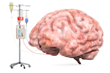 Intravenous therapy system with human brain. Treatment of Brain Diseases concept. 3D rendering