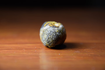 Large gallstone, Gall bladder stone. The result of gallstones