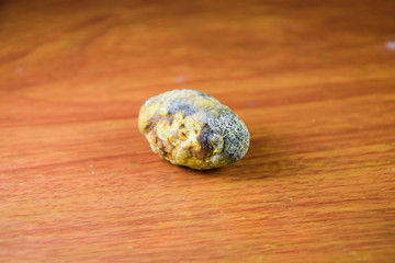 Large gallstone, Gall bladder stone. The result of gallstones