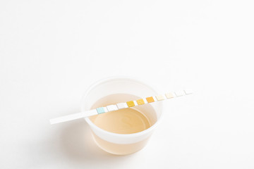 A set of urine sample on a round plastic cup with a single unused urine reagent strip against a plain white background.