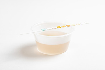 A set of urine sample on a round plastic cup with a single unused urine reagent strip against a plain white background.