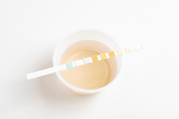 A set of urine sample on a round plastic cup with a single unused urine reagent strip against a...