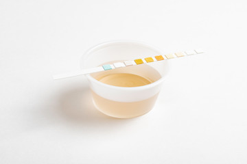 A set of urine sample on a round plastic cup with a single unused urine reagent strip against a plain white background.