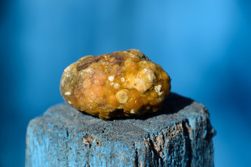 Gall bladder stone. Calculus of heterogeneous composition