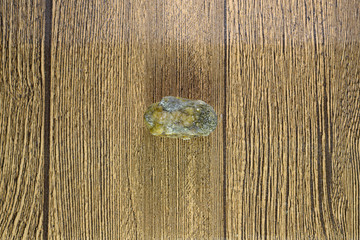 Large gallstone, Gall bladder stone. result of gallstones. Calculus of heterogeneous composition