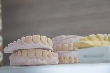 protesis para odontologia, en consultorio de dentista