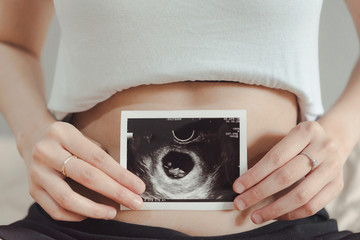 Young pregnant woman looking at 8 Weeks x-ray ultrasound scan of baby