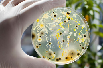 Researcher hand in glove holding Petri dish with colonies of different bacteria and molds on...
