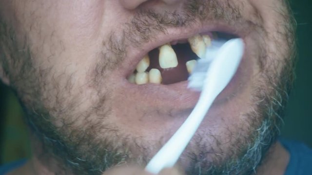 toothless man brushing his teeth. loose teeth in a middle-aged man. before a medical examination.