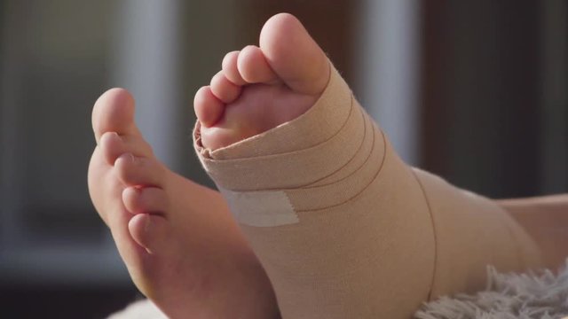 Close up of a persons injured right foot wrapped in a bandage
