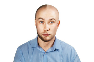 Portrait Man before and after hair loss, transplant on isolated white background. Split personality.