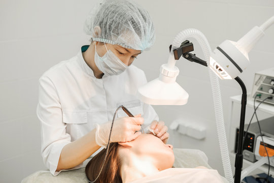 Medical treatment removal of birthmark from female patient's face. Female dermatologist surgeon using a professional electrocautery for removing mole. Radio wave electrocoagulation remove method