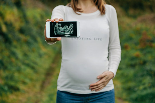 Unrecognizable pregnant woman showing ultrasound of her baby on the mobile. Selective focus on mobile in foreground